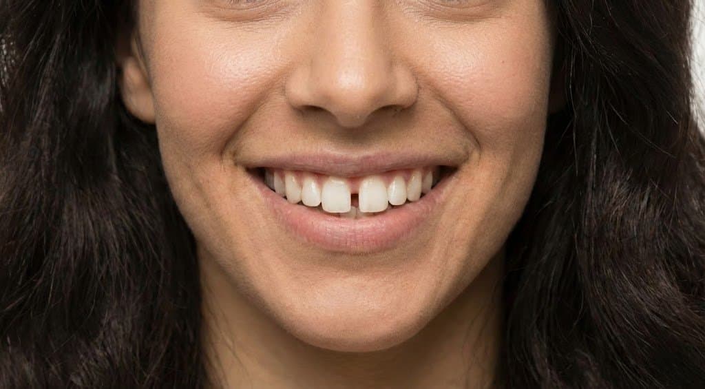 Diestema